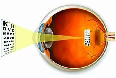 10 Bệnh về mắt phổ biến thường gặp nhất